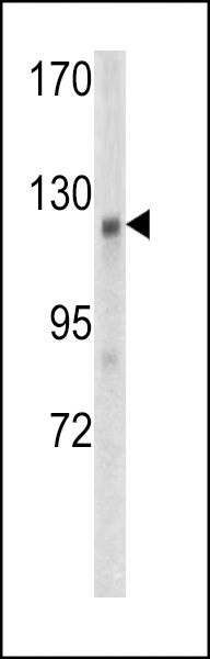 Western blot analysis of WTX antibody (Center) (Cat. #AP6553c) in mouse kidney tissue lysates (35ug/lane). WTX (arrow) was detected using the purified Pab.