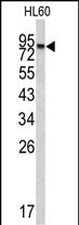 WB - CPXM2 Antibody (N-term) AP6561a