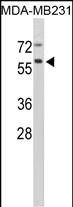 Western blot analysis of CTSF Antibody (Center D276) (Cat. #AP6569b) in MDA-MB231 cell line lysates (35ug/lane). CTSF (arrow) was detected using the purified Pab.