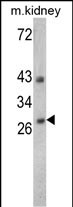 Western blot analysis of ENDOG Antibody (C-term) (Cat. 3AP6571b) in 293,K562,Jurkat,NCI-H460 cell line lysates and mouse kidney tissues lysates(35ug/lane). ENDOG (arrow) was detected using the purified Pab.