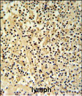GZMB Antibody (N-term) (Cat. #AP6575a) IHC analysis in formalin fixed and paraffin embedded human Lymph tissue followed by peroxidase conjugation of the secondary antibody and DAB staining.  This data demonstrates the use of the GZMB Antibody (N-term) for immunohistochemistry.  Clinical relevance has not been evaluated.