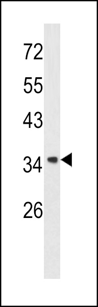 Western blot analysis of Annexin A1 antibody (Center) (Cat. #AP6584c) in A2058 cell line lysates (35ug/lane). Annexin A1 (arrow) was detected using the purified Pab.