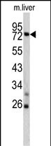 Western blot analysis of TNFAIP2 antibody (Center) (Cat. #AP6593c) in mouse liver lysates (35ug/lane). TNFAIP2 (arrow) was detected using the purified Pab.
