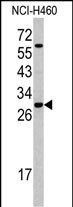 WB - SFRS5 Antibody (Center Y85) AP6620c