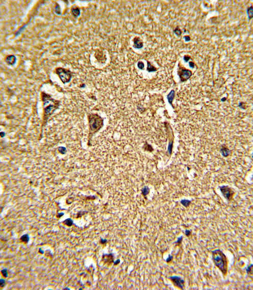 IHC-P - CACNG5 Antibody (C-term) AP6630b