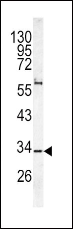 WB - CACNG5 Antibody (C-term) AP6630b