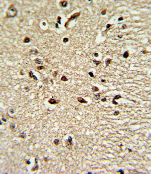 IHC-P - PAX4 Antibody (Center) AP6690C
