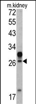 Western blot analysis of HOXA5 antibody (C-term E211) (Cat. #AP6694b) in mouse kidney tissue lysates (35ug/lane). HOXA5 (arrow) was detected using the purified Pab.
