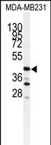 Western blot analysis of CTSS antibody (Center) (Cat.# AP7382c) in MDA-MB231 cell line lysates (35ug/lane). CTSS (arrow) was detected using the purified Pab.