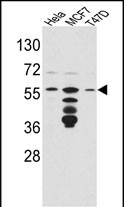 Western blot analysis of FKBP4 Antibody (Center) (Cat. #AP7387c) in Hela,MCF7,T47D cell line lysates(35ug/lane).FKBP4(arrow) was detected using the purified Pab.