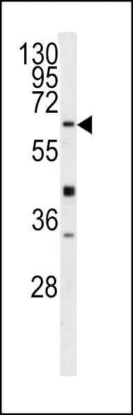 Western blot analysis of GGTLA1 antibody (N-term) (Cat.# AP7392a) in Y79 cell line lysates (35ug/lane). GGTLA1 (arrow) was detected using the purified Pab.