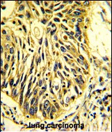 IHC-P - CD201 Antibody (Center) AP2887c