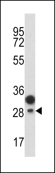 Western blot analysis of CD201 antibody (Center) (Cat. #AP2887c) in T47D cell line lysates (35ug/lane). CD201 (arrow) was detected using the purified Pab.