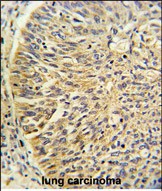 IHC-P - CCT3 Antibody (Center) AP2890c