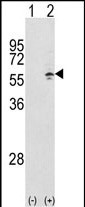 WB - CCT3 Antibody (Center) AP2890c