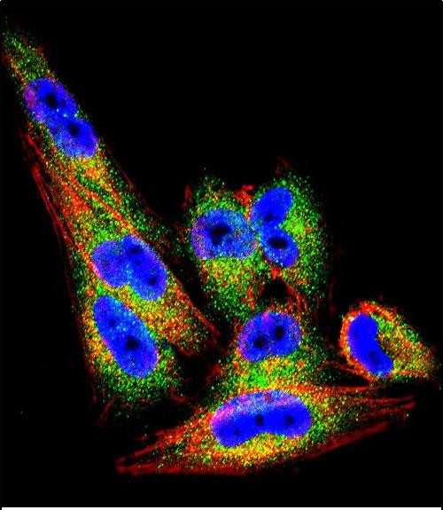 Confocal immunofluorescent analysis of TIMP1 Antibody (N-term)(Cat#AP6709a) with A2058 cell followed by Alexa Fluor 488-conjugated goat anti-rabbit lgG (green). Actin filaments have been labeled with Alexa Fluor 555 phalloidin (red).DAPI was used to stain the cell nuclear (blue).
