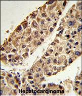 IHC-P - ITIH2 Antibody (C-term) AP6712b