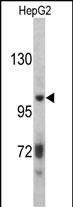WB - ITIH2 Antibody (C-term) AP6712b