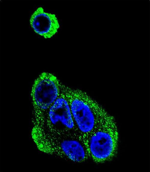 Confocal immunofluorescent analysis of ADH1B Antibody (Center)(Cat#AP6738c) with HepG2 cell followed by Alexa Fluor� 488-conjugated goat anti-rabbit lgG (green). DAPI was used to stain the cell nuclear (blue).