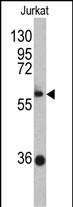 WB - ZBTB2 Antibody (C-term) AP6747b