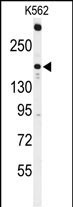 Western blot analysis of ACK1 Antibody (N-term) (Cat. #AP7696a) in K562 cell line lysates (35ug/lane). ACK1 (arrow) was detected using the purified Pab.