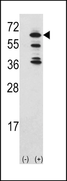 Western blot analysis of ACK1 (arrow) using rabbit polyclonal ACK1 Antibody (Center) (Cat. #AP7696c). 293 cell lysates (2 ug/lane) either nontransfected (Lane 1) or transiently transfected with the ACK1 gene (Lane 2) (60 KD recombinant protein).