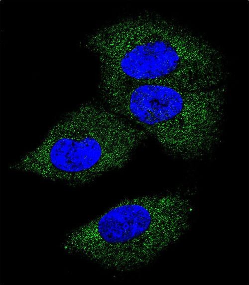 Confocal immunofluorescent analysis of M-CSF Antibody (Center)(Cat#AP6754c) with MDA-MB231 cell followed by Alexa Fluor 488-conjugated goat anti-rabbit lgG (green).DAPI was used to stain the cell nuclear (blue).