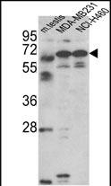 WB - Fascin-3 Antibody (N-term) AP6757c