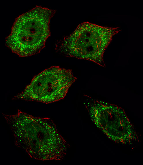 Fluorescent image of U251 cell stained with UCHL1 Antibody (C-term)(Cat#AP2126e/SA120806AG).U251 cells were fixed with 4% PFA (20 min), permeabilized with Triton X-100 (0.1%, 10 min), then incubated with UCHL1 primary antibody (1:25, 1 h at 37?). For secondary antibody, Alexa Fluor� 488 conjugated donkey anti-rabbit antibody (green) was used (1:400, 50 min at 37?).Cytoplasmic actin was counterstained with Alexa Fluor� 555 (red) conjugated Phalloidin (7units/ml, 1 h at 37?). UCHL1 immunoreactivity is localized to Cytoplasm and Nucleus significantly.
