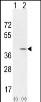 Western blot analysis of CCND1 (arrow) using rabbit polyclonal CCND1 Antibody (Center) (Cat. c#AP2612c). 293 cell lysates (2 ug/lane) either nontransfected (Lane 1) or transiently transfected with the CCND1 gene (Lane 2) (Origene Technologies).