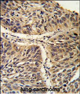 IHC-P - CCT3 Antibody (C-term) AP2890b