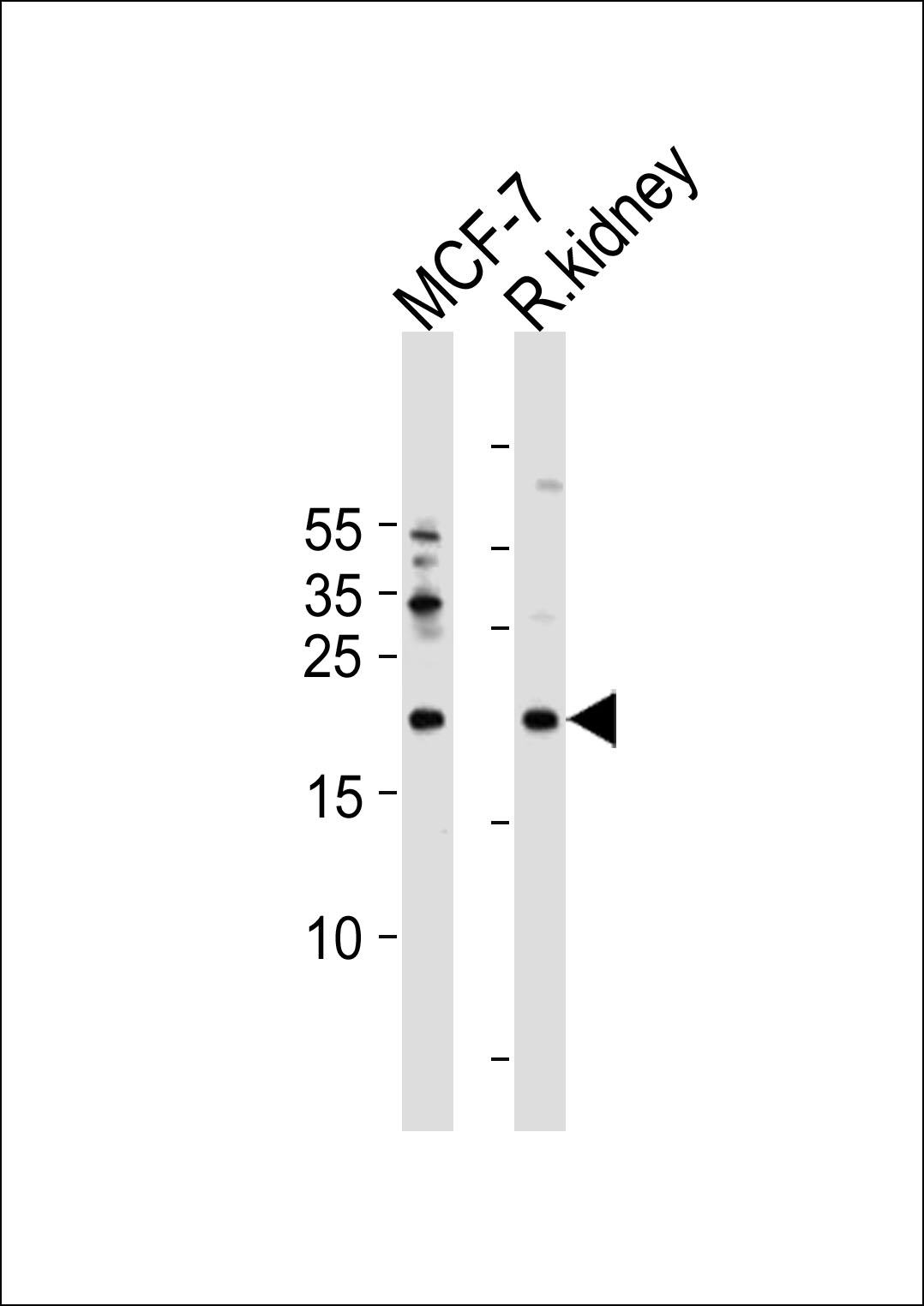 APRT Antibody (C-term) (Cat. #AP2893b) western blot analysis in MCF-7 cell line and rat kidney tissue lysates (35ug/lane).This demonstrates the APRT antibody detected the APRT protein (arrow).