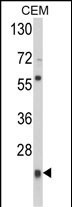 Western blot analysis of PRDX1 Antibody (Center) (Cat. #AP2924c) in CEM cell line lysates (35ug/lane). PRDX1 (arrow) was detected using the purified Pab.