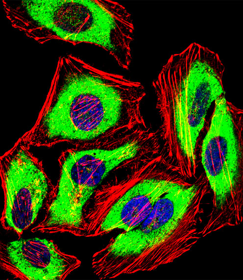 Fluorescent confocal image of Hela cell stained with PRDX2 Antibody (C-term)(Cat#AP2925b).Hela cells were fixed with 4% PFA (20 min), permeabilized with Triton X-100 (0.1%, 10 min), then incubated with PRDX2 primary antibody (1:25, 1 h at 37?). For secondary antibody, Alexa Fluor� 488 conjugated donkey anti-rabbit antibody (green) was used (1:400, 50 min at 37?).Cytoplasmic actin was counterstained with Alexa Fluor� 555 (red) conjugated Phalloidin (7units/ml, 1 h at 37?). Nuclei were counterstained with DAPI (blue) (10 �g/ml, 10 min).PRDX2 immunoreactivity is localized to Cytoplasm significantly.