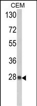 Western blot analysis of PRDX6 Antibody (C-term) (Cat. #AP2927b) in CEM cell line lysates (35ug/lane). PRDX6 (arrow) was detected using the purified Pab.