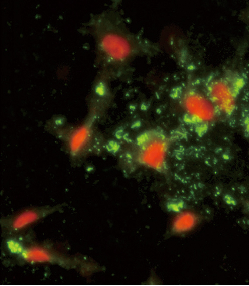 Immunofluorescence analysis of ARPC1A Antibody (C-term) with hela cells. 0.025 mg/ml primary antibody was followed by FITC-conjugated goat anti-rabbit lgG (whole molecule). FITC emits green fluorescence.Red counterstaining is PI.