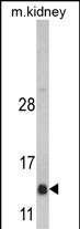 Western blot analysis of DNAJC19 Antibody (Center) (Cat. #AP6542c) in mouse kidney tissue lysates (35ug/lane). DNAJC19 (arrow) was detected using the purified Pab.