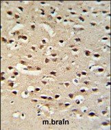 IHC-P - Chromogranin-C Antibody (Center) AP6796c