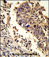 IHC-P - LUC7L Antibody (C-term) AP6889b