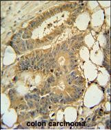 IHC-P - EPS8L3 Antibody (N-term) AP6911a