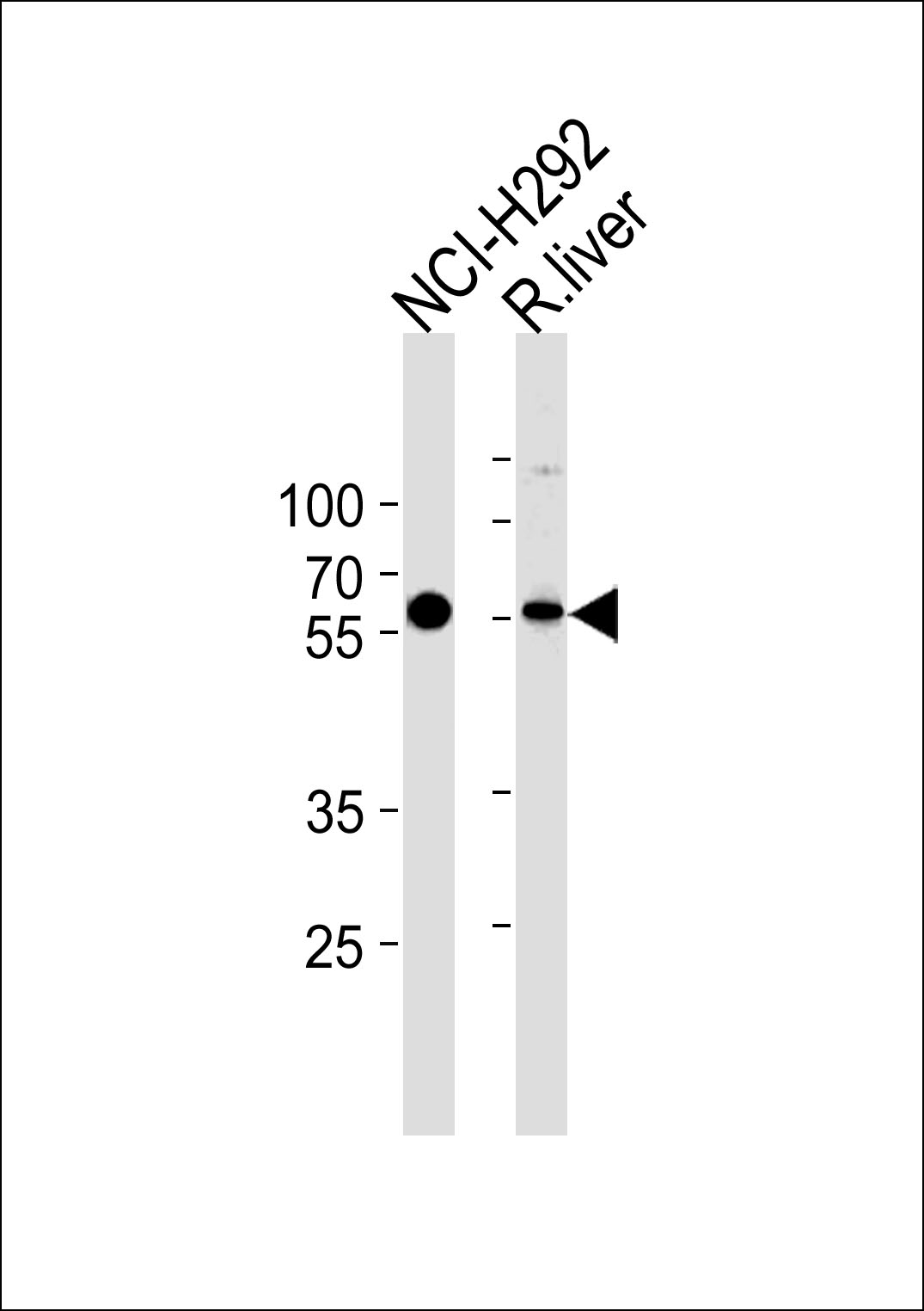 MCCC2 Antibody (Center) (Cat. #AP6924c) western blot analysis in NCI-H292 cell line and rat liver tissue lysates (35ug/lane).This demonstrates the MCCC2 antibody detected the MCCC2 protein (arrow).