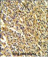IHC-P - KCNJ2 Antibody (C-term) AP6926c