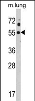 WB - KCNJ2 Antibody (C-term) AP6926c