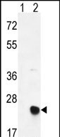 Western blot analysis of MSRB2 (arrow) using rabbit polyclonal MSRB2 Antibody (Center) (Cat. #AP6980c). 293 cell lysates (2 ug/lane) either nontransfected (Lane 1) or transiently transfected (Lane 2) with the MSRB2 gene.