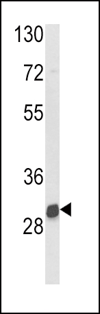 WB - NAT2 Antibody (C-term) AP6993B