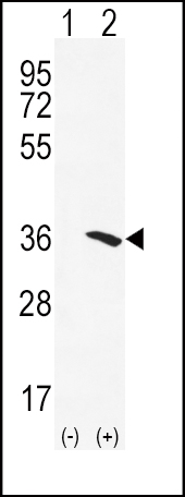 WB - NAT2 Antibody (C-term) AP6993B