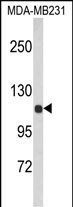 Western blot analysis of ACTN1 Antibody (N-term) (Cat. #AP8512a) in MDA-MB231 cell line lysates (35ug/lane). ACTN1 (arrow) was detected using the purified Pab.