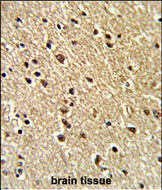 IHC-P - ZFP36 Antibody (Center) AP8520c