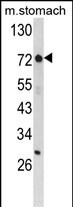 Western blot analysis of ZFP36 Antibody (Center) (Cat. #AP8520c) in mouse stomach tissue lysates (35ug/lane).ZFP36 (arrow) was detected using the purified Pab.(8ug/ml)