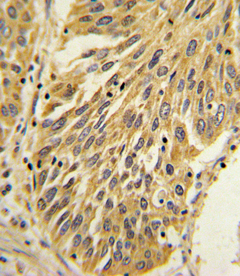 IHC-P - IL1B Antibody (Center) AP8531C